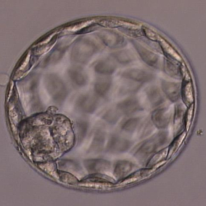 胚盤胞移植の画像